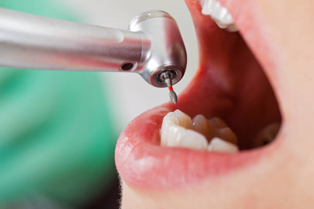Best Emergency Dentist for Special Needs Patients in Ransom Canyon, TX
